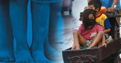 LIFE+STYLE-HEALTH & HOME  | 1 in 4 Filipino kids under age 5 stunted: study
